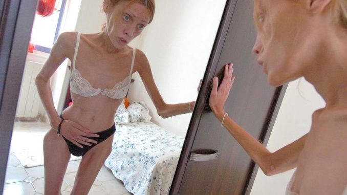 Isabelle Caro: Modelka, která světu ukázala anorexii. Billboardy s ní byly v některých zemích zakázány