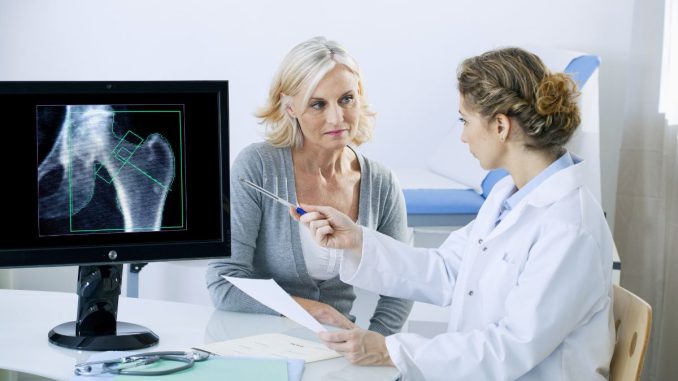 Osteoporóza: Jak souvisí úbytek kostní hmoty s ženskou menopauzou a lze se mu bránit?